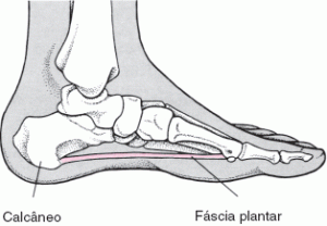 calcaneo 1